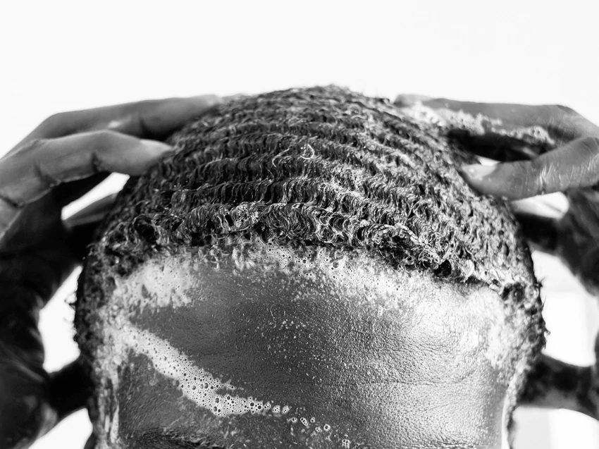 Anxiety & hair loss explained