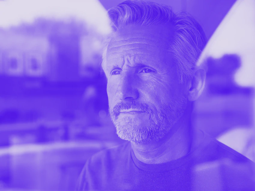 Why Is My Hair So Thin?